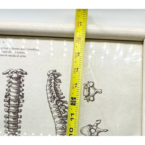 Skeleton Skeletal Spine Framed Artwork Picture - Picture 4 of 4